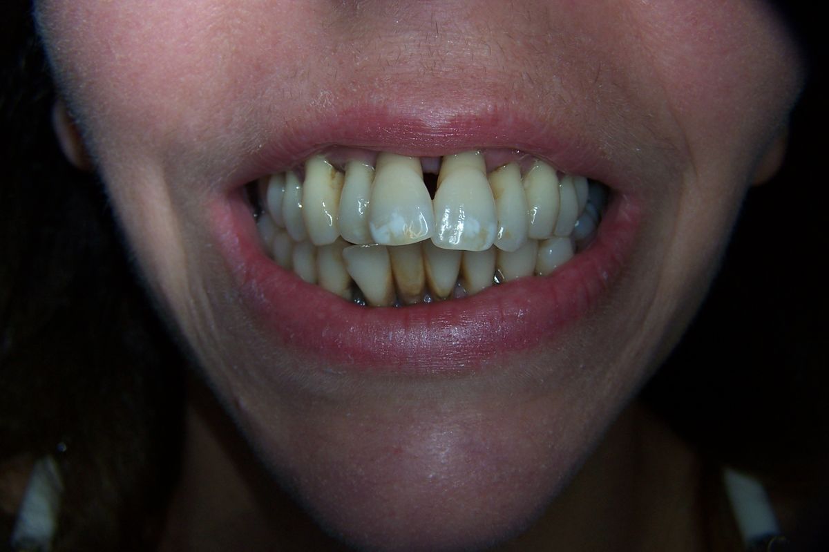 Gallery Country Club Dental Care